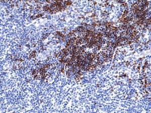 TdT Antibody in Immunohistochemistry (Paraffin) (IHC (P))