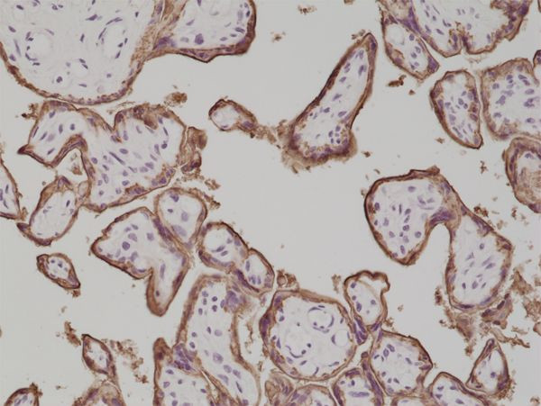 Placental Alkaline Phosphatase Antibody in Immunohistochemistry (Paraffin) (IHC (P))