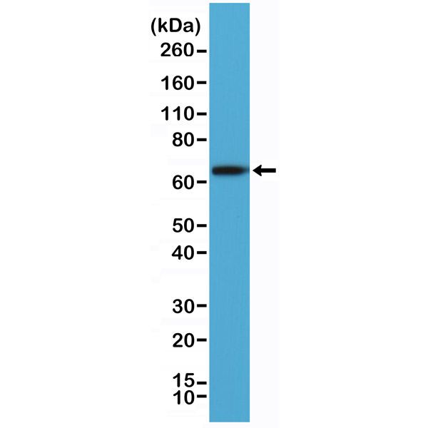 Placental Alkaline Phosphatase Antibody in Western Blot (WB)