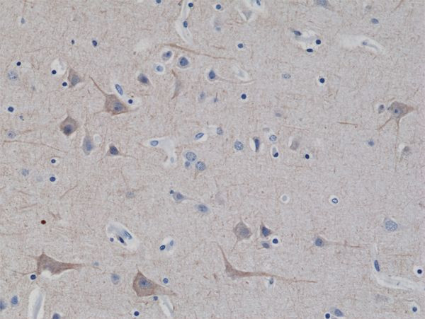 NEFL Antibody in Immunohistochemistry (Paraffin) (IHC (P))