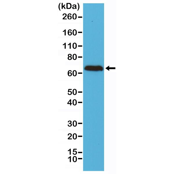 NEFL Antibody in Western Blot (WB)