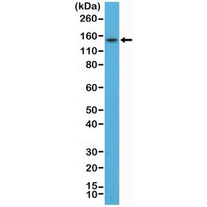 Thyroid Peroxidase Antibody in Western Blot (WB)