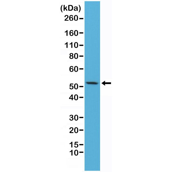 Cytokeratin 7 Antibody in Immunohistochemistry (Paraffin) (IHC (P))