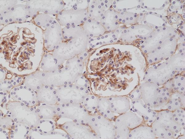 PDGFRB Antibody in Immunohistochemistry (Paraffin) (IHC (P))