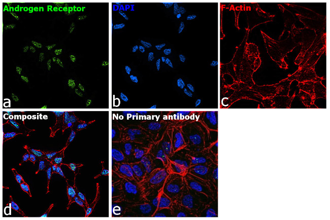 Androgen Receptor Antibody in Immunocytochemistry (ICC/IF)