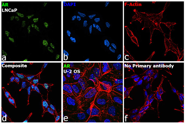 Androgen Receptor Antibody in Immunocytochemistry (ICC/IF)