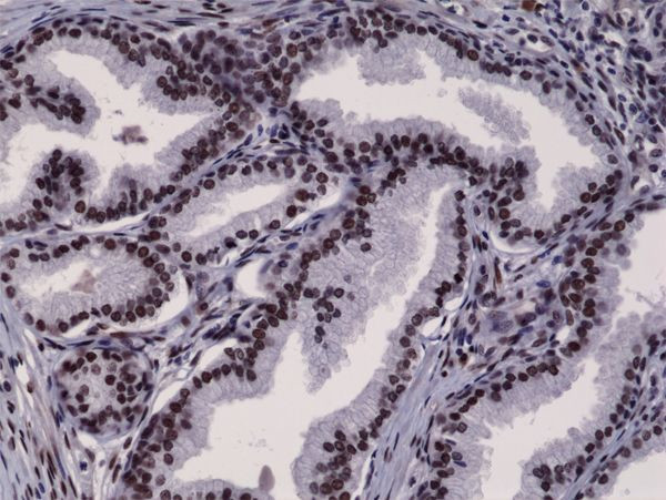 Androgen Receptor Antibody in Immunohistochemistry (Paraffin) (IHC (P))