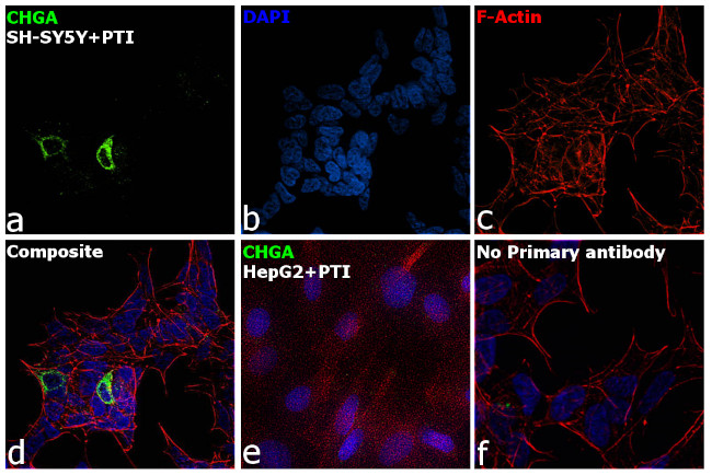 Chromogranin A Antibody in Immunocytochemistry (ICC/IF)