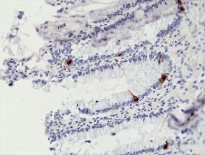 Chromogranin A Antibody in Immunohistochemistry (Paraffin) (IHC (P))