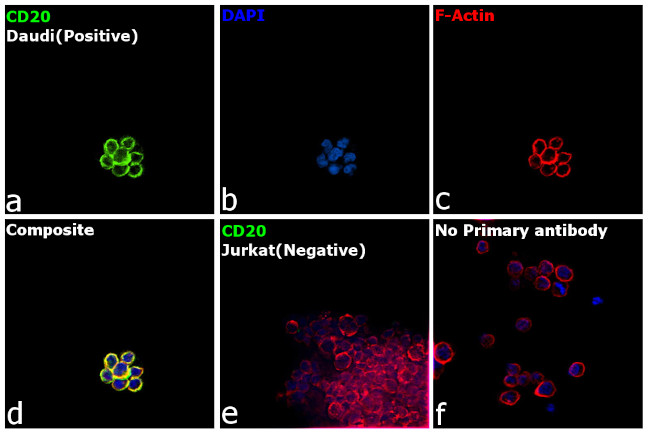 CD20 Antibody in Immunocytochemistry (ICC/IF)