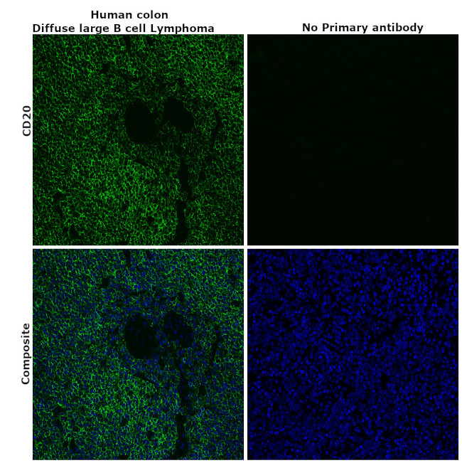 CD20 Antibody in Immunohistochemistry (Paraffin) (IHC (P))