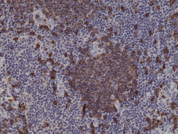 CD20 Antibody in Immunohistochemistry (Paraffin) (IHC (P))