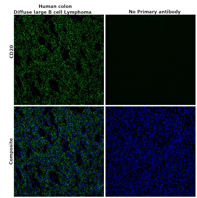 CD20 Antibody in Immunohistochemistry (Paraffin) (IHC (P))