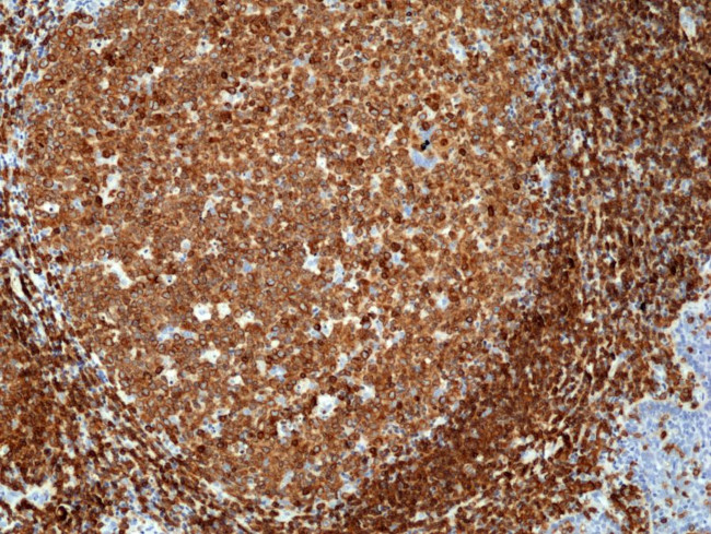 CD79a Antibody in Immunohistochemistry (Paraffin) (IHC (P))