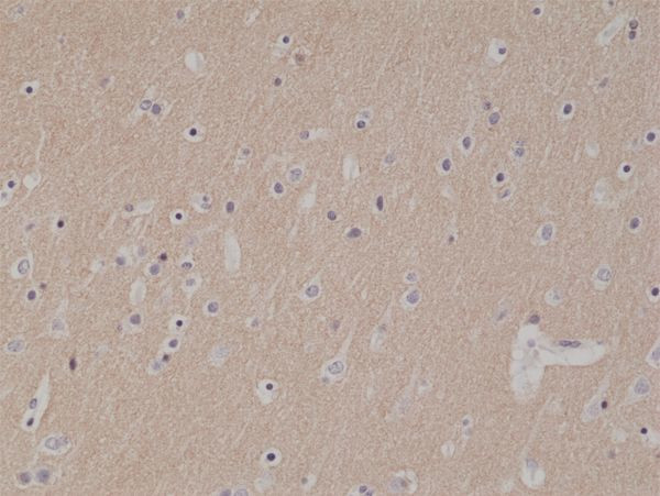 CD56 (NCAM) Antibody in Immunohistochemistry (Paraffin) (IHC (P))