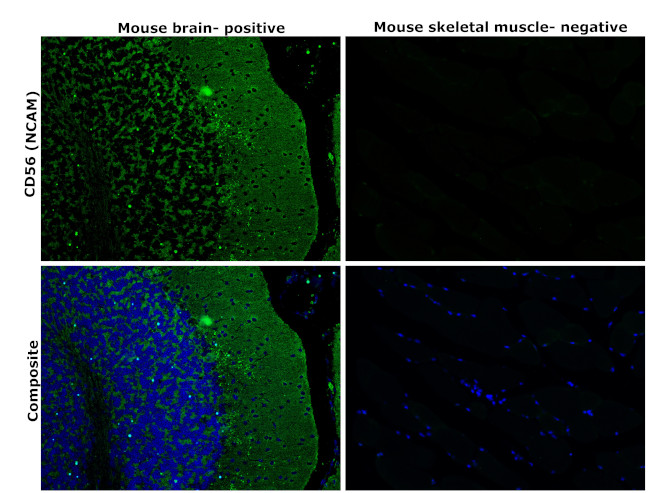 CD56 (NCAM) Antibody in Immunohistochemistry (Paraffin) (IHC (P))