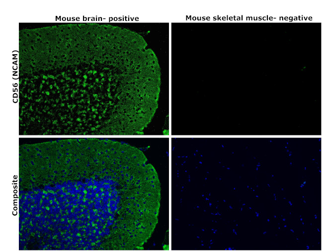 CD56 (NCAM) Antibody in Immunohistochemistry (Paraffin) (IHC (P))