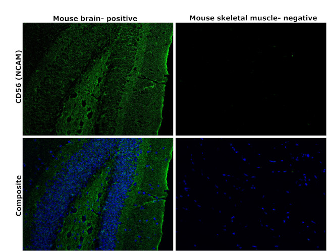 CD56 (NCAM) Antibody in Immunohistochemistry (Paraffin) (IHC (P))