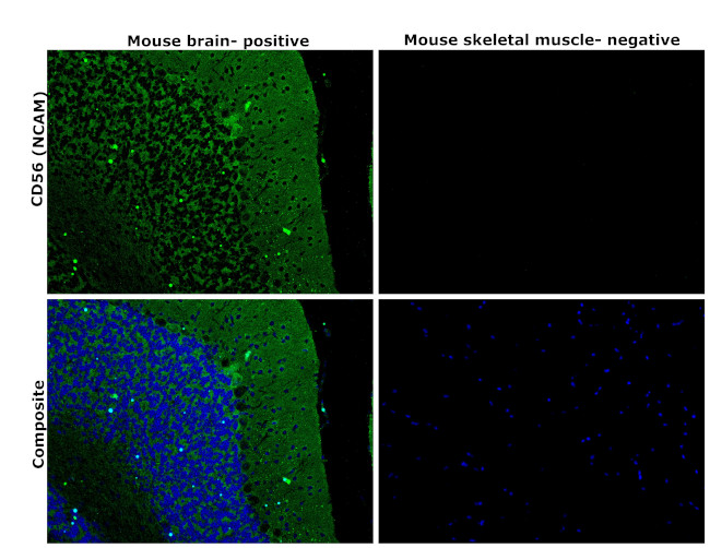 CD56 (NCAM) Antibody