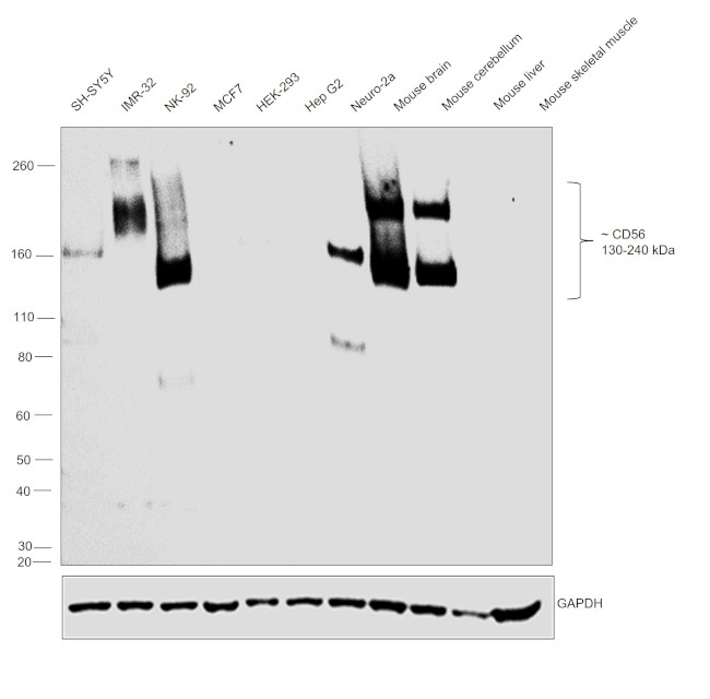 CD56 (NCAM) Antibody in Western Blot (WB)