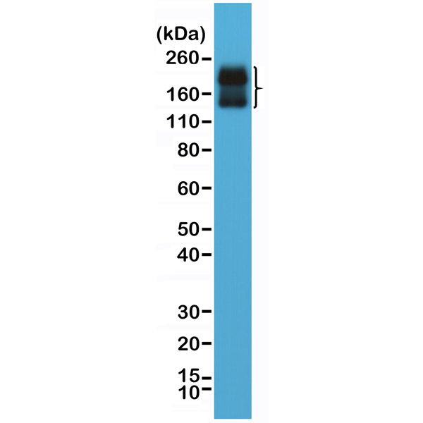 CD56 (NCAM) Antibody in Western Blot (WB)