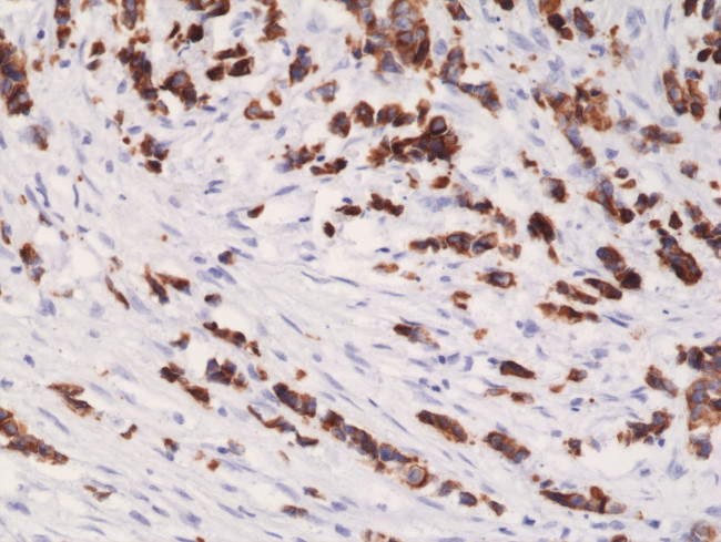 Cytokeratin 19 Antibody in Immunohistochemistry (Paraffin) (IHC (P))