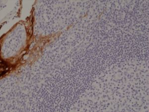 Cytokeratin 4 Antibody in Immunohistochemistry (Paraffin) (IHC (P))