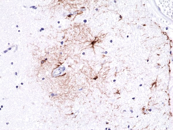 GFAP Antibody in Immunohistochemistry (Paraffin) (IHC (P))