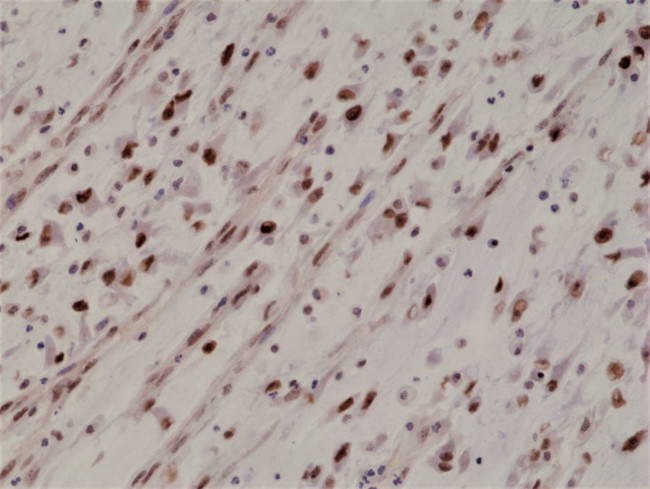 MYOD Antibody in Immunohistochemistry (Paraffin) (IHC (P))