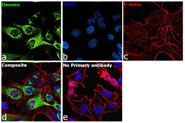 Desmin Antibody in Immunocytochemistry (ICC/IF)