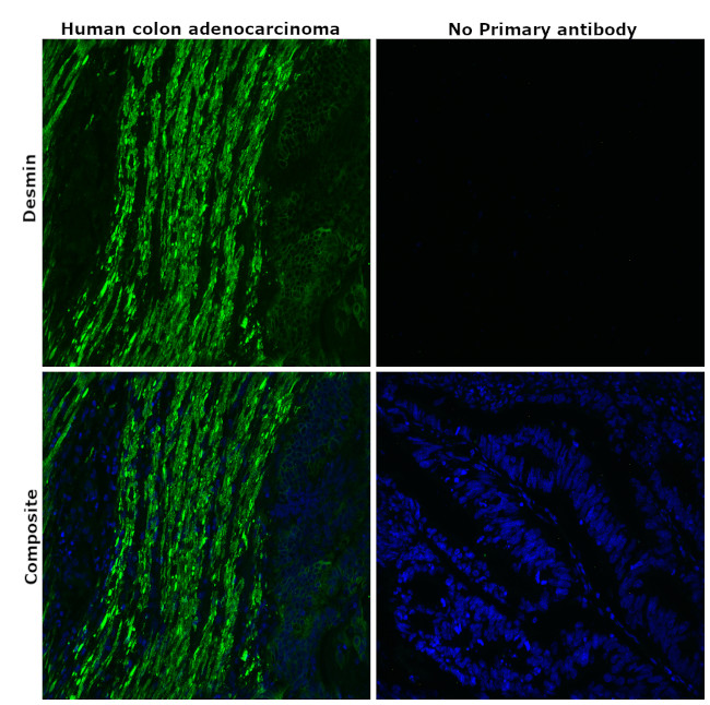 Desmin Antibody in Immunohistochemistry (Paraffin) (IHC (P))