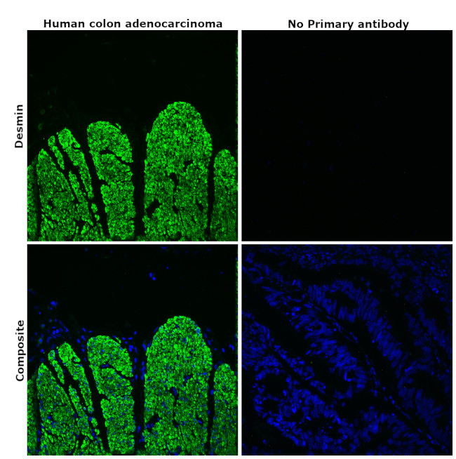 Desmin Antibody in Immunohistochemistry (Paraffin) (IHC (P))