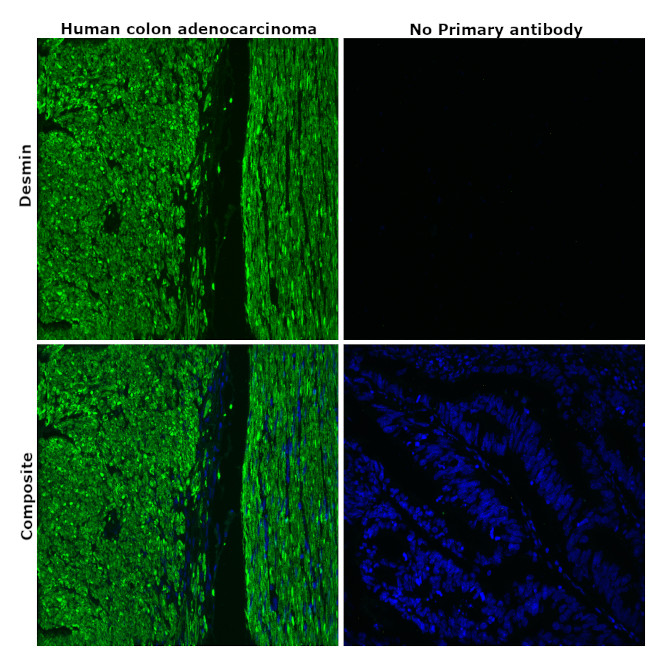 Desmin Antibody in Immunohistochemistry (Paraffin) (IHC (P))