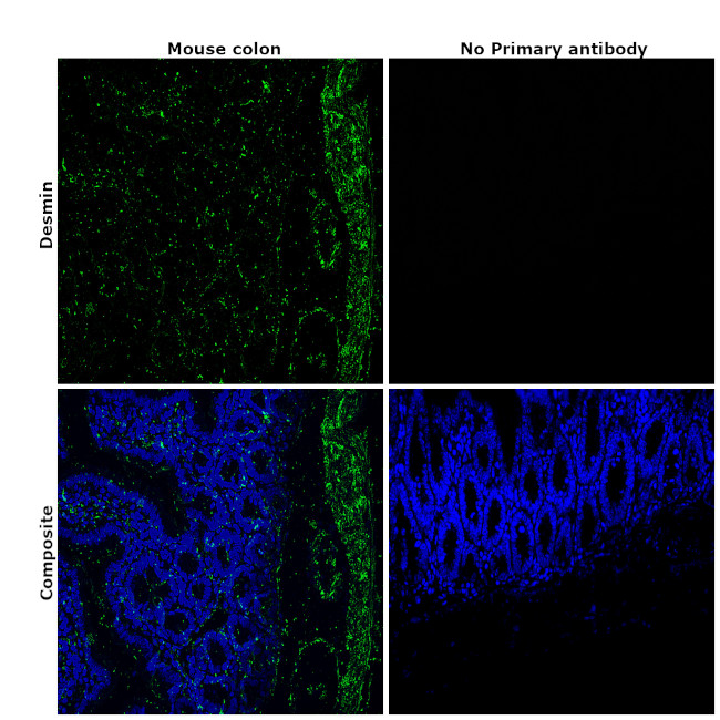 Desmin Antibody in Immunohistochemistry (Paraffin) (IHC (P))