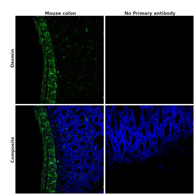 Desmin Antibody in Immunohistochemistry (Paraffin) (IHC (P))