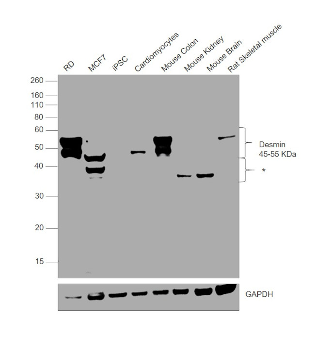 Desmin Antibody in Western Blot (WB)