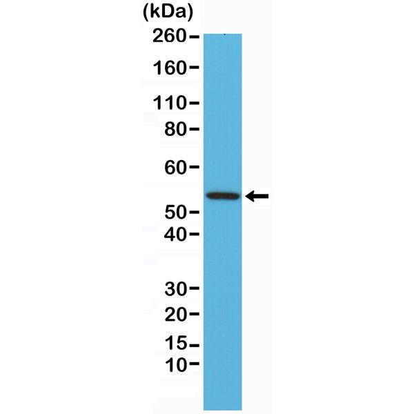 Desmin Antibody in Western Blot (WB)