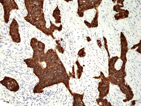 Cytokeratin 5 Antibody in Immunohistochemistry (Paraffin) (IHC (P))