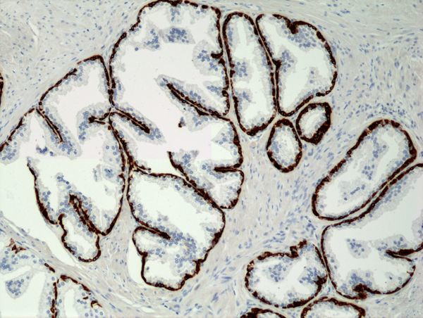 Cytokeratin 5 Antibody in Immunohistochemistry (Paraffin) (IHC (P))