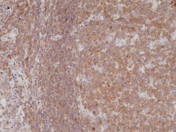 NFkB p50/p105 Antibody in Immunohistochemistry (Paraffin) (IHC (P))