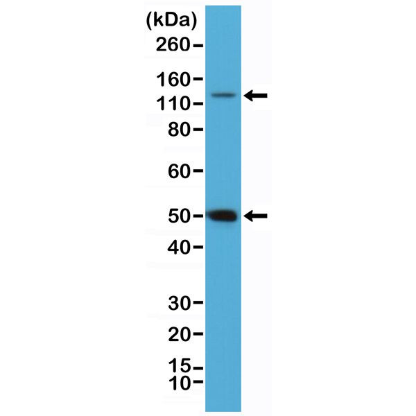 NFkB p50/p105 Antibody in Western Blot (WB)