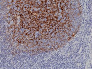 CD21 Antibody in Immunohistochemistry (Paraffin) (IHC (P))