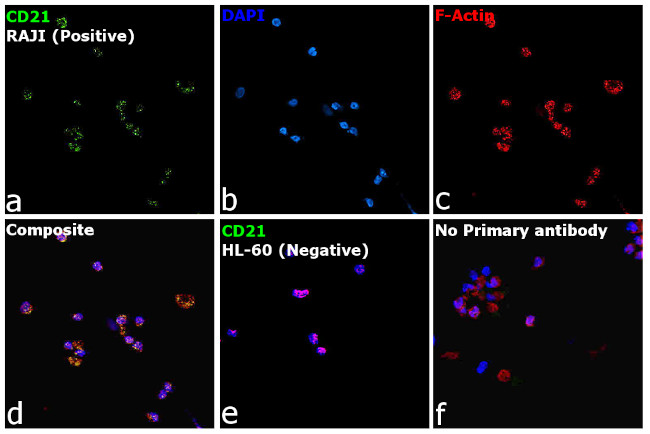 CD21 Antibody