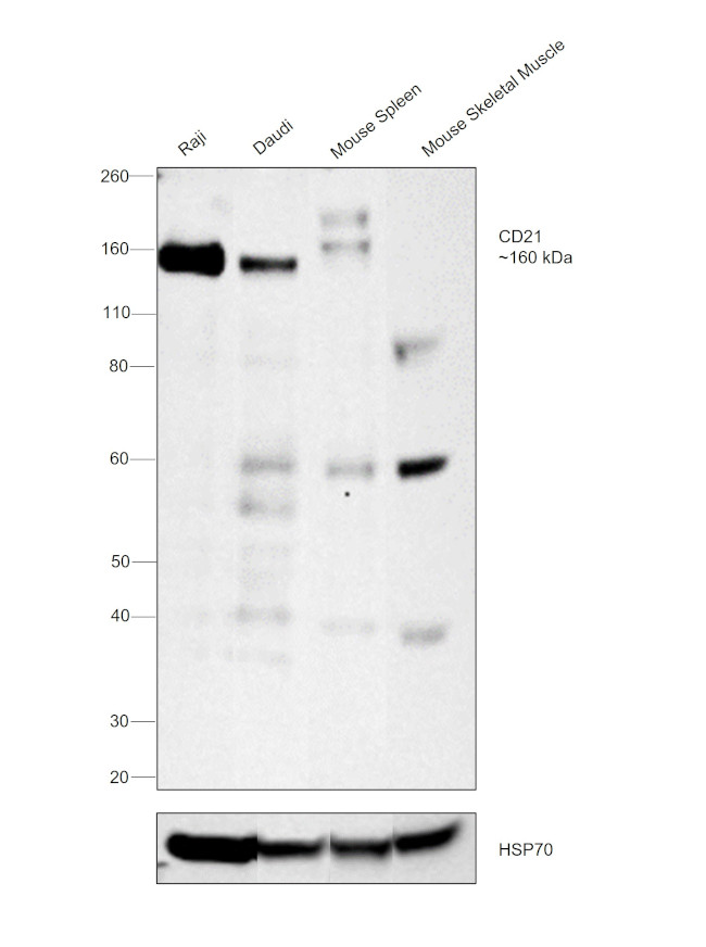 CD21 Antibody in Western Blot (WB)