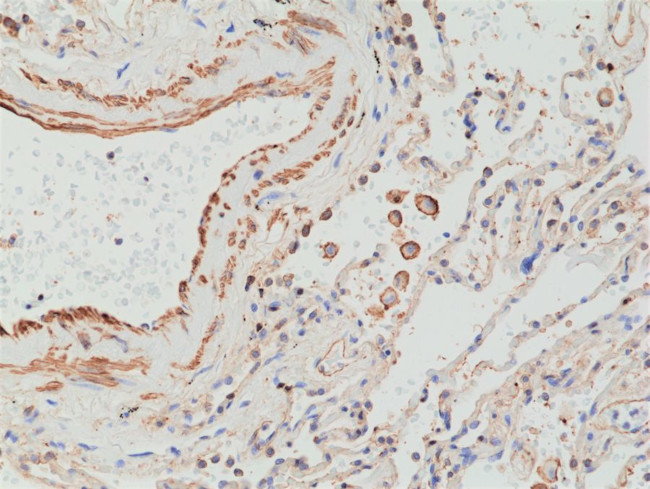 MMP12 Antibody in Immunohistochemistry (Paraffin) (IHC (P))