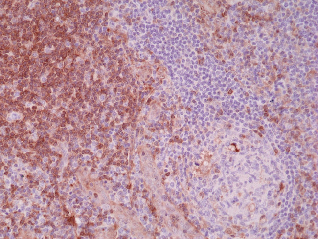 Paxillin Antibody in Immunohistochemistry (Paraffin) (IHC (P))