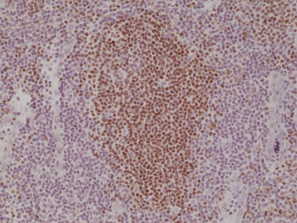 PAX5 Antibody in Immunohistochemistry (Paraffin) (IHC (P))