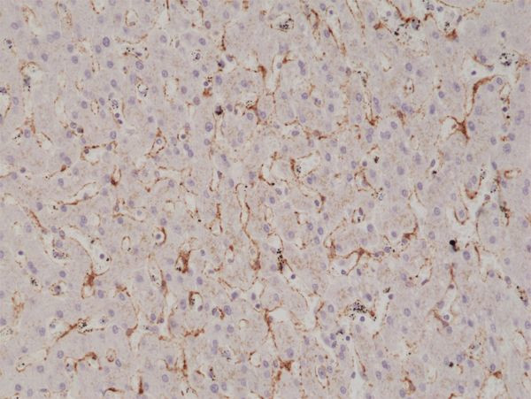 Caveolin 1 Antibody in Immunohistochemistry (Paraffin) (IHC (P))