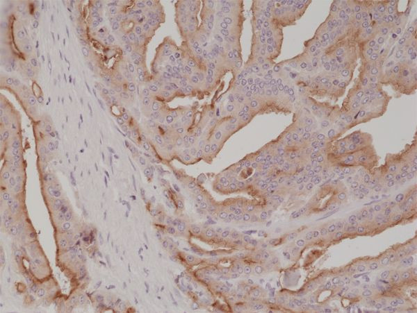 PSMA Antibody in Immunohistochemistry (Paraffin) (IHC (P))