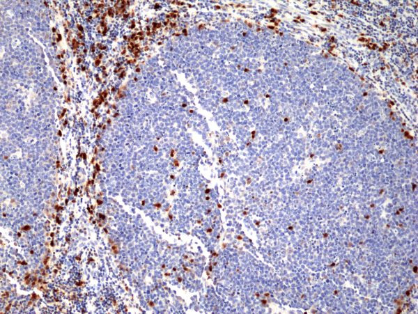 IRF4 Antibody in Immunohistochemistry (Paraffin) (IHC (P))